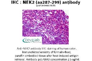 Image no. 2 for anti-NIMA (Never in Mitosis Gene A)-Related Kinase 2 (NEK2) (AA 287-299) antibody (ABIN1737250) (NEK2 antibody  (AA 287-299))