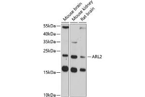 Western blot analysis of extracts of various cell lines, using  antibody (ABIN3016794, ABIN3016795, ABIN3016796 and ABIN6219841) at 1:3000 dilution. (ARL2 antibody  (AA 1-184))