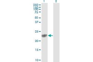 Western Blot analysis of GSTP1 expression in transfected 293T cell line by GSTP1 monoclonal antibody (M01), clone 2G6-F6. (GSTP1 antibody  (AA 1-210))