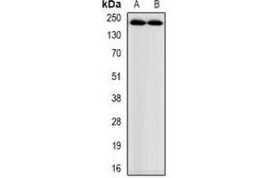 Western blot analysis of Myosin-pan (AcK505) expression in mouse heart (A), rat heart (B) whole cell lysates. (Myosin-Pan (acLys505) antibody)