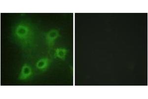 Immunofluorescence analysis of COS7 cells, using SYK (Ab-323) Antibody. (SYK antibody  (AA 289-338))