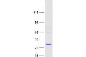 Validation with Western Blot (COMMD2 Protein (Myc-DYKDDDDK Tag))