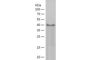 Western Blotting (WB) image for Tumor Protein P63 (TP63) (AA 1-200) protein (His-IF2DI Tag) (ABIN7125563) (p63 Protein (AA 1-200) (His-IF2DI Tag))