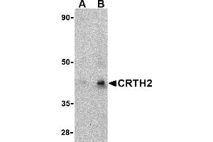 Western blot analysis of CRTH2 in human heart tissue lysate with CRTH2 antibody at (A) 1 and (B) 2 µg/mL. (Prostaglandin D2 Receptor 2 (PTGDR2) (Middle Region) antibody)