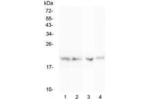 Western blot testing of rat 1) spleen, 2) thymus, 3) lung and 4) testis lysate with BCMA antibody at 0. (BCMA antibody)