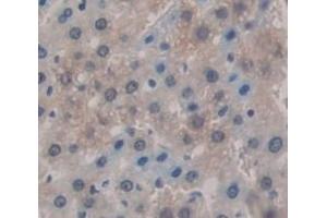 #VALUE! (KNG1 antibody  (AA 367-430))