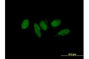 Immunofluorescence of purified MaxPab antibody to MED9 on HeLa cell.