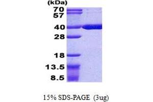 SDS-PAGE (SDS) image for Acyl-CoA Thioesterase 8 (ACOT8) (AA 1-319) protein (His tag) (ABIN5852990)