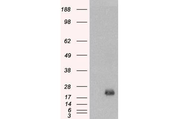 BAALC antibody  (Internal Region)