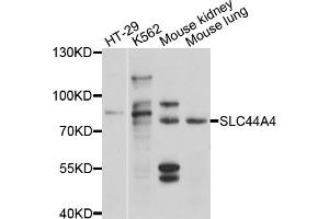 Western blot analysis of extracts of various cell lines, using SLC44A4 antibody (ABIN4905203) at 1:1000 dilution.