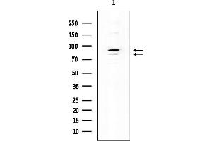 anti-DENN/MADD Domain Containing 1B (DENND1B) antibody