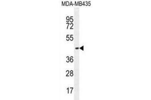 Western Blotting (WB) image for anti-Olfactory Receptor, Family 2, Subfamily L, Member 13 (OR2L13) antibody (ABIN2996118) (OR2L13 antibody)