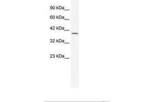 Image no. 1 for anti-Gastrulation Brain Homeo Box 2 (GBX2) (AA 181-230) antibody (ABIN202301) (GBX2 antibody  (AA 181-230))