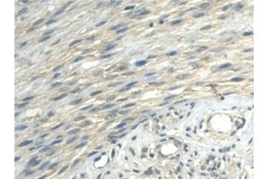 Immunohistochemistry (IHC) image for anti-Aldehyde Dehydrogenase 1 Family, Member A2 (ALDH1A2) (AA 1-422) antibody (ABIN7435901)