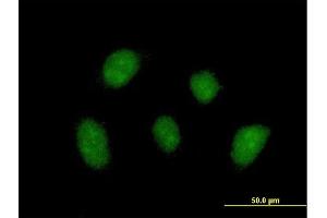 Immunofluorescence of purified MaxPab antibody to ZNF710 on HeLa cell.