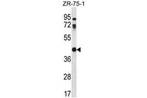 CTSO Antibody (N-term) western blot analysis in ZR-75-1 cell line lysates (35µg/lane). (CTSO antibody  (N-Term))