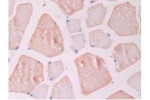 IHC-P analysis of Rat Skeletal Muscle Tissue, with DAB staining.