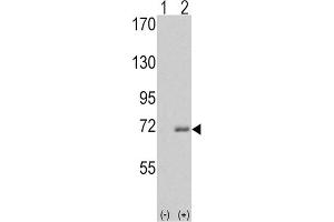 Western blot analysis of IRAK1 (arrow) using rabbit polyclonal IRAK Antibody (C-term). (IRAK1 antibody)