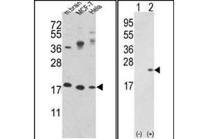Western blot analysis of CFL1 Antibody (N-term) (ABIN389443 and ABIN2839515) in MCF-7,Hela cell line and mouse brain tissue lysates (35 μg/lane). (Cofilin antibody  (N-Term))