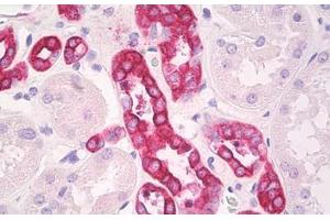 Image no. 2 for anti-Arginine Vasopressin Receptor 2 (AVPR2) (C-Term) antibody (ABIN1492332) (AVPR2 antibody  (C-Term))