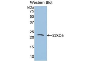 Western Blotting (WB) image for anti-Tumor Protein, Translationally-Controlled 1 (TPT1) (AA 1-172) antibody (ABIN5662059) (TPT1 antibody  (AA 1-172))