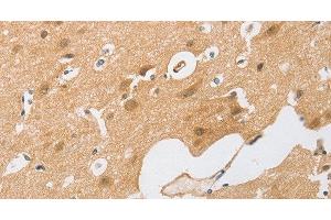 Immunohistochemistry of paraffin-embedded Human brain tissue using CEBP beta Polyclonal Antibody at dilution 1:60 (CEBPB antibody)