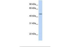 Image no. 1 for anti-Transducin (Beta)-Like 2 (TBL2) (AA 38-87) antibody (ABIN6738879) (TBL2 antibody  (AA 38-87))