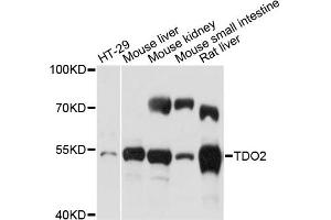 Western blot analysis of extracts of various cell lines, using TDO2 antibody (ABIN6292384) at 1:500 dilution. (TDO2 antibody)