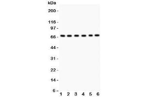 Western blot testing of PKC iota antibody and Lane 1:  SHG-44;  2: A549;  3: U87;  4: 293T;  5: HeLa;  6: Jurkat. (PKC iota antibody  (AA 21-214))