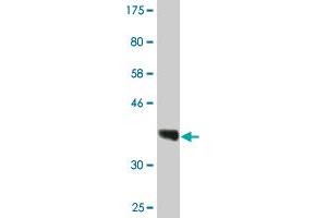 Western Blot detection against Immunogen (36. (RPRD1A antibody  (AA 76-170))