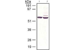 RPE65 detected in bovine and human samples using RPE65 monoclonal antibody, clone 401. (RPE65 antibody)