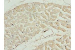 Immunohistochemistry of paraffin-embedded human heart tissue using ABIN7173581 at dilution of 1:100 (TNNI2 antibody  (AA 1-100))