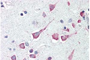 Human Brain, Cortex (formalin-fixed, paraffin-embedded) stained with DAPK3 antibody ABIN214482 at 2. (DAPK3 antibody  (Internal Region))