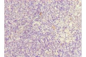 Immunohistochemistry of paraffin-embedded human thymus tissue using ABIN7169185 at dilution of 1:100 (SIK3 antibody  (AA 60-310))