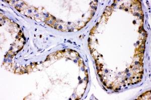 IHC analysis of AMHR2 using anti-AMHR2 antibody (ABIN4886456).
