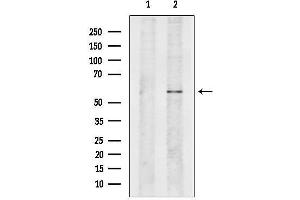 anti-NEDD8 Activating Enzyme E1 Subunit 1 (NAE1) (N-Term) antibody