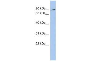 WB Suggested Anti-ZNF711 Antibody Titration:  0. (ZNF711 antibody  (N-Term))