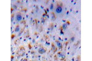 IHC-P analysis of Liver tissue, with DAB staining. (HFE2 antibody  (AA 29-401))