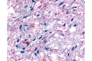 Anti-GPR50 antibody IHC of human pituitary. (GPR50 antibody  (Cytoplasmic Domain))