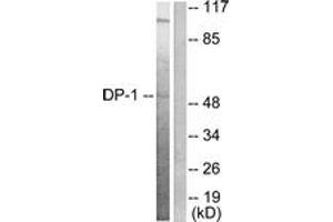 Western blot analysis of extracts from HeLa cells, using DP-1 Antibody.