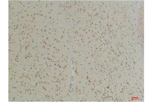 Immunohistochemistry (IHC) analysis of paraffin-embedded Mouse Brain Tissue using GABA Transporter 1 Rabbit Polyclonal Antibody diluted at 1:200. (SLC6A1 antibody)