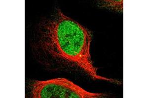 Immunofluorescent staining of U-2 OS with MCM3 polyclonal antibody  (Green) shows positivity in centrosome and nucleus but excluded from the nucleoli.