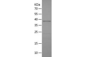 Western Blotting (WB) image for Transforming, Acidic Coiled-Coil Containing Protein 3 (TACC3) (AA 390-689) protein (His tag) (ABIN7125462) (TACC3 Protein (AA 390-689) (His tag))