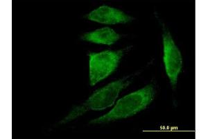 Immunofluorescence of purified MaxPab antibody to TMSB4X on HeLa cell. (TMSB4X antibody  (AA 1-44))