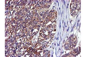 Image no. 1 for anti-LIM Domain Kinase 1 (LIMK1) antibody (ABIN1499147) (LIM Domain Kinase 1 antibody)