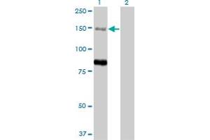 Western Blot analysis of MTMR3 expression in transfected 293T cell line by MTMR3 monoclonal antibody (M07A), clone 1E11. (MTMR3 antibody  (AA 579-674))