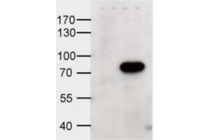 HEK293 overexpressing human ABCD1 and probed with ABIN334339 at 1ug/ml (mock transfection in first lane). (ABCD1 antibody  (Internal Region))