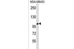 ANKRD20A3 Antibody (C-term) (ABIN1537600 and ABIN2850333) western blot analysis in MDA-M cell line lysates (35 μg/lane). (ANKRD20A3 antibody  (C-Term))