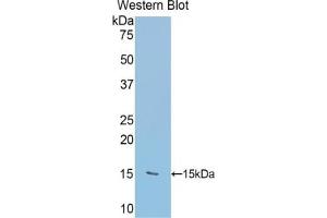 Detection of Recombinant RALBP1, Human using Polyclonal Antibody to RalA Binding Protein 1 (RALBP1) (RALBP1 antibody  (AA 403-499))