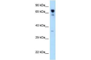 WB Suggested Anti-RARS Antibody Titration: 1. (RARS antibody  (C-Term))